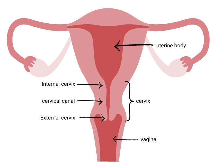 Schematic diagram of the female reproductive organs with labels: uterine body, internal os, cervical canal, external os, cervix, and vagina.