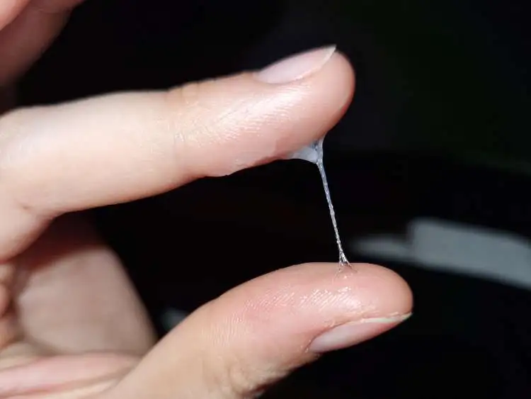 Glassy, stretchy S+ cervical mucus with whitish streaks starting on cycle day 10
