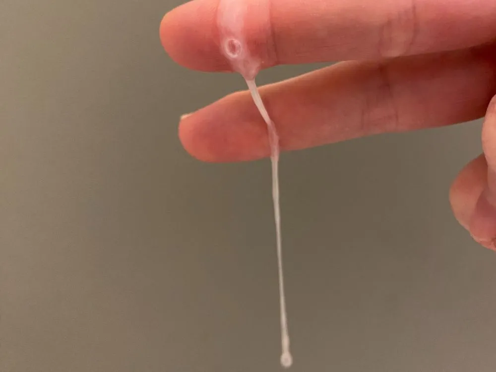 Liquid cervical mucus on cycle day 9 (S+), natural birth control with trackle