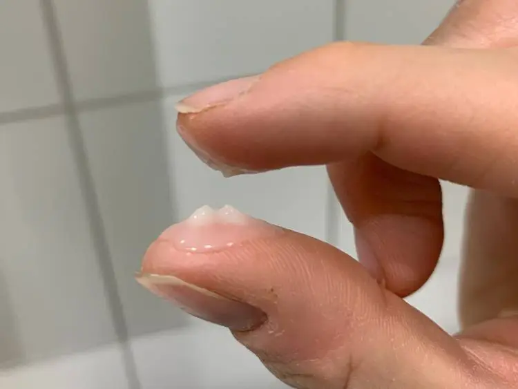 Whitish, clumpy cervical mucus just before ovulation